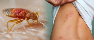 7 Insect Bites You Shouldn&#39;t Ignore