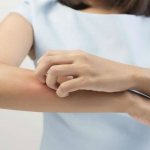 Wart itches: causes, possible diseases, treatment methods, reviews