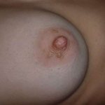 Breast warts are caused by the human papillomavirus