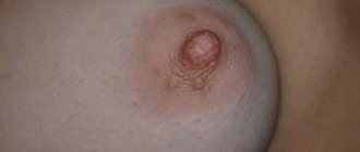 Breast warts are caused by the human papillomavirus