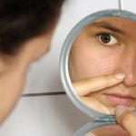 What causes inflammation on the face