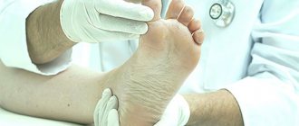 Diagnosis of growths on the foot