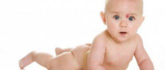 Hemangioma in a baby