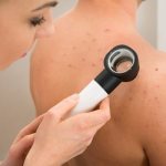 How to get rid of acne on your back and shoulders quickly at home
