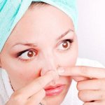 Как избавиться от угрей на носу