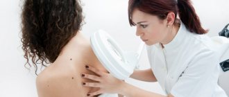 examination of moles in a pregnant woman