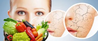 Основные правила питания при сухой коже