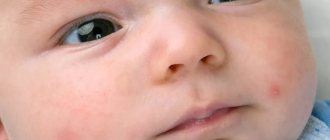 Why do snow-white spots appear on a baby’s face?