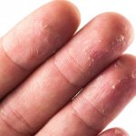 Подушечки пальцев шершавые: причины. Кончики пальцев стали твердыми — что делать