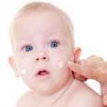 Потница у ребенка: симптомы и лечение, как выглядит, опрелости на лице, шее, ногах, руках, в паху, под мышками