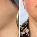 Reasons for the appearance of a double chin in women