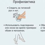 профилактика грибка ногтей