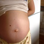 What are moles during pregnancy?