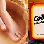 Soda baths for treating foot fungus
